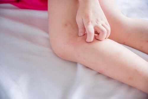 Comprendre l'allergie au latex chez les enfants : symptômes et solutions efficaces