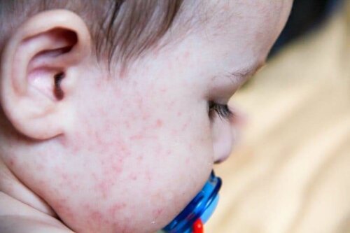 Irritations cutanées chez les bébés : guide complet des symptômes et traitements